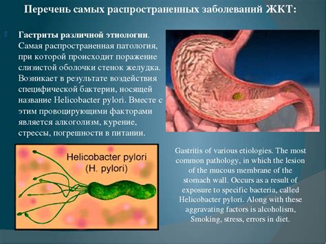 Что означает ЖКТ в медицине?