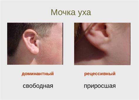 Что означает отсутствие мочки уха?