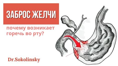 Что означает отсутствие рефлюкса?