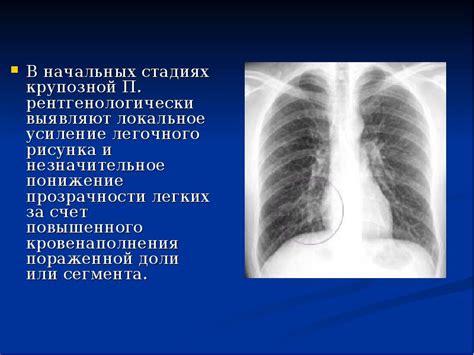 Что означает уплотнение легочных корней?