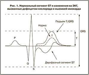 Что означает 8 баллов?