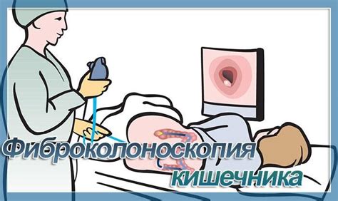 Что показывает ФКС обследование кишечника?