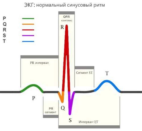 Что показывает кардиограмма с нагрузкой?