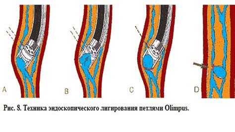 Что приводит к битью по яйцам?