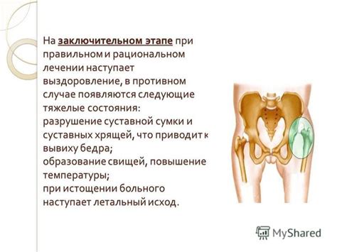 Что приводит к супинации бедра?