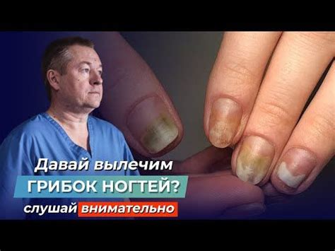 Что причиняет ощущение горячих ног: шокирующая правда