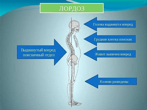 Что происходит при нарушении физиологического поясничного лордоза?