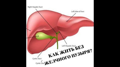 Что происходит с пищеварительной системой без желчного пузыря?