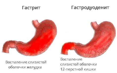 Что такое "разбить сердце мужчины": причины и сущность