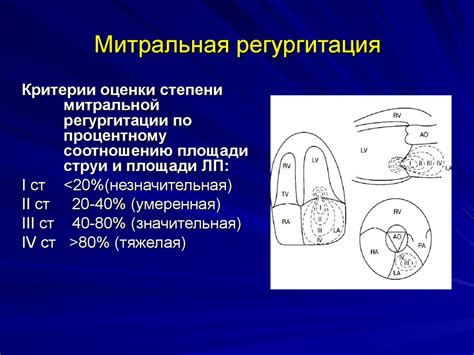 Что такое "трикуспидальная регургитация не определяется"?