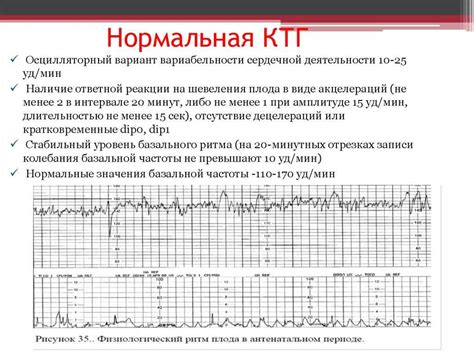 Что такое КТГ: показатели и их значение