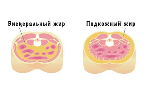 Что такое висцеральный и подкожный жир?