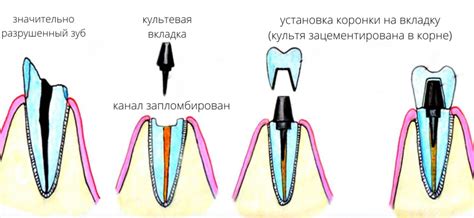 Что такое вкладка и штифт?