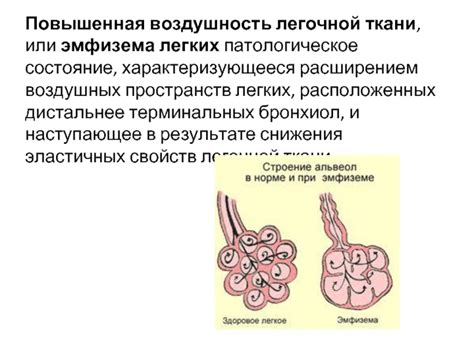 Что такое воздушность легочной ткани?