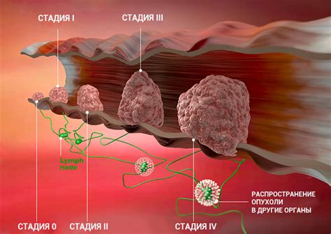 Что такое воспалительный генез