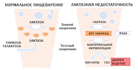 Что такое вторичная лактазная недостаточность?