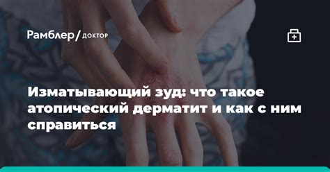 Что такое генерализованный зуд?