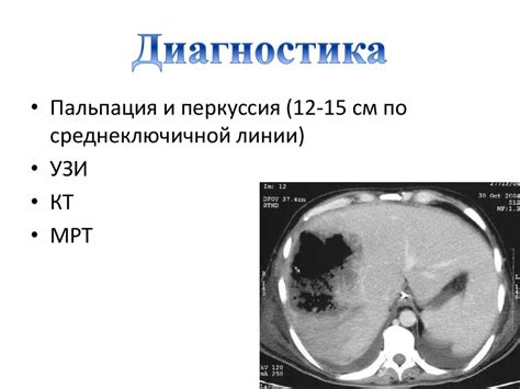 Что такое гепатомегалия печени у детей?