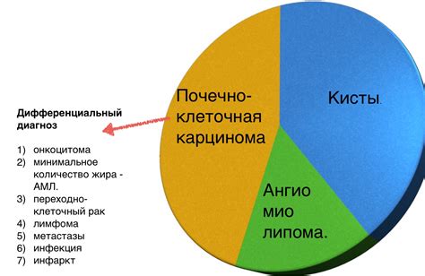 Что такое гиподенсное образование