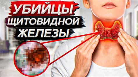 Что такое гипотиреоз щитовидной железы?