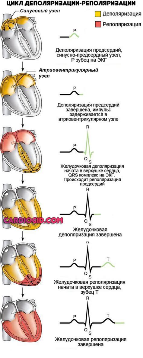 Что такое дискордантность реполяризации?