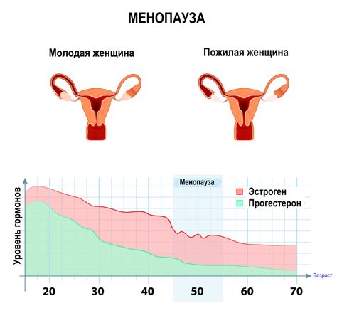 Что такое климакс у женщин?