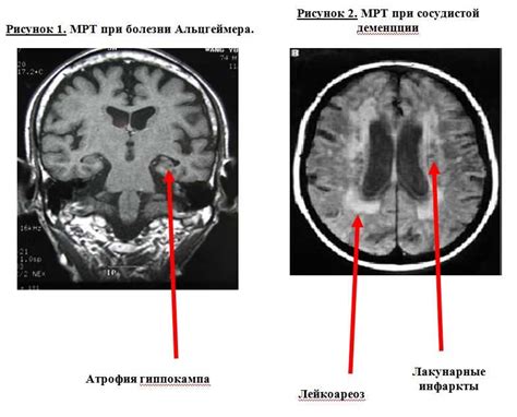 Что такое когнитивное состояние?