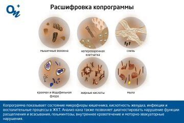 Что такое копрограмма консистенция мягкая?