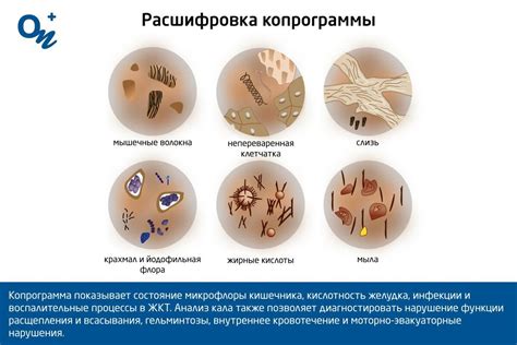 Что такое копрограмма реакция кислая?