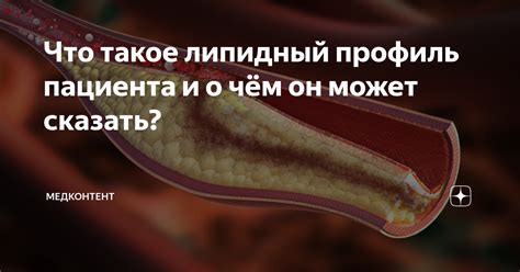 Что такое липидный контроль и почему он важен для нас?