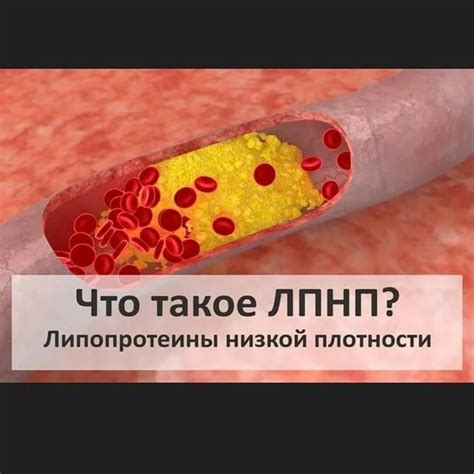 Что такое липопротеин низкой плотности?