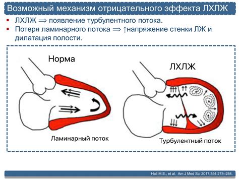 Что такое ложная хорда