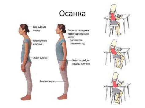 Что такое лордотическая осанка?