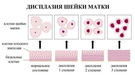 Что такое мазок эпителия?