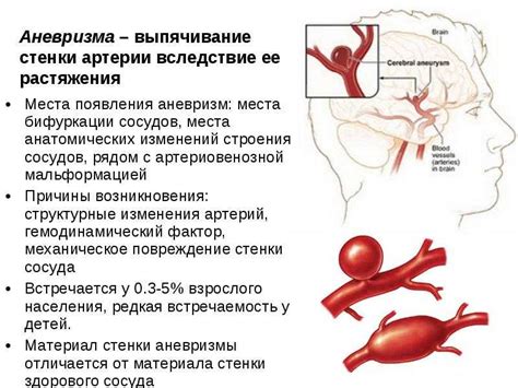 Что такое мешотчатая аневризма?