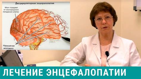 Что такое микроангиоэнцефалопатия головного мозга?