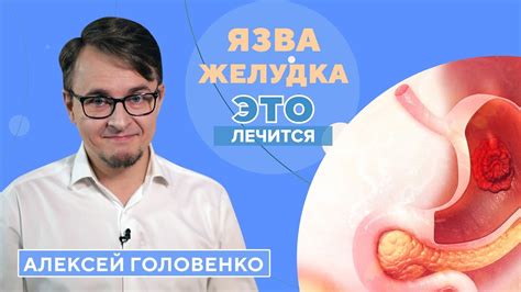 Что такое мобилизация желудка и как она происходит?