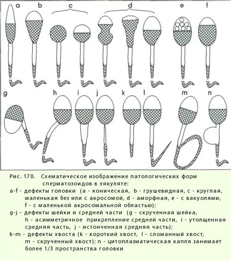 Что такое морфология по Крюгеру 1 процент