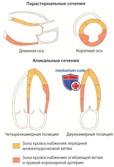 Что такое нарушение локальной сократимости миокарда ЛЖ?