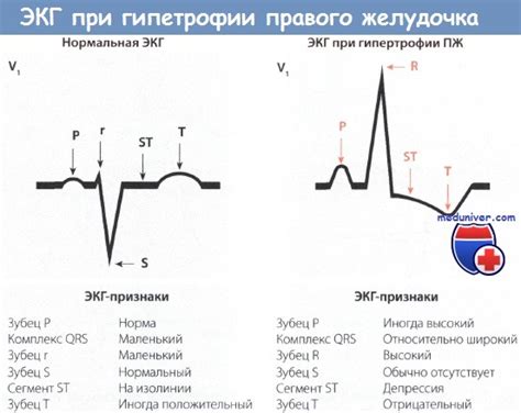 Что такое начальная глж сердца?