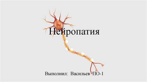 Что такое нейропатия срединного нерва верхних конечностей?