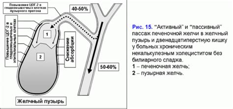 Что такое некалькулезный холецистит?