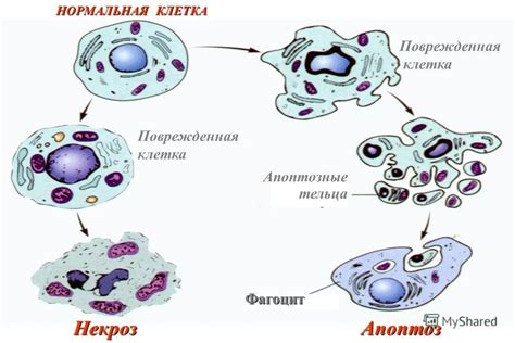 Что такое некроз тканей