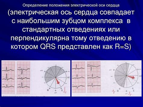 Что такое неопределенное положение эос?