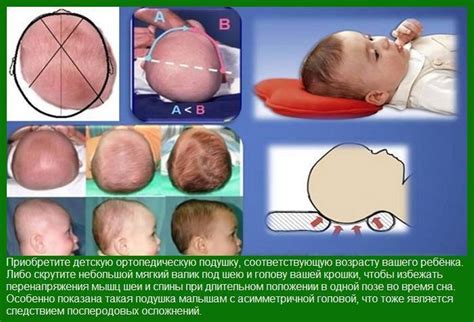 Что такое неровная голова у грудничка
