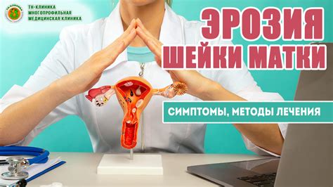 Что такое неспецифический эндоцервицит?