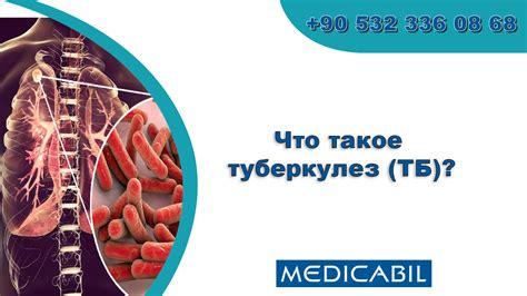 Что такое неформальность?