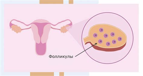 Что такое не лопнувший фолликул?