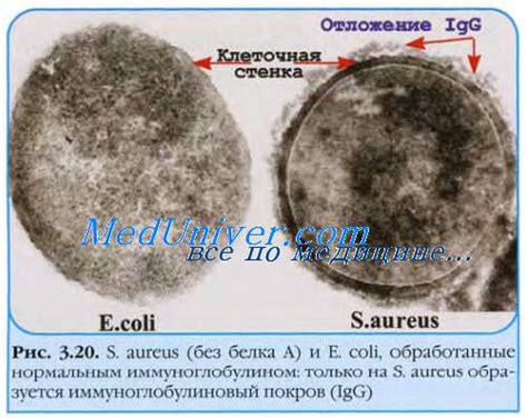 Что такое носительство золотистого стафилококка?