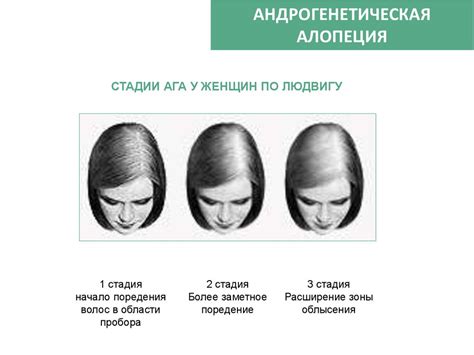 Что такое оволосение по женскому типу и какие причины его вызывают?